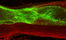 Individuate cellule staminali che riparano lesioni al midollo spinale