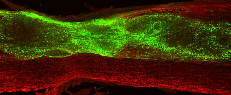 Individuate cellule staminali che riparano lesioni al midollo spinale