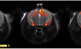 Serotonina, la molecola della felicità