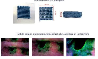 Al via il progetto europeo Giotto per combattere l’osteoporosi